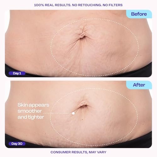 Tighten & Smooth Belly Cream - Quick Absorbing for Smoother, Firmer-Looking Skin