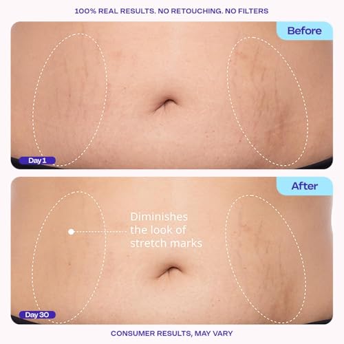 Tighten & Smooth Belly Cream - Quick Absorbing for Smoother, Firmer-Looking Skin