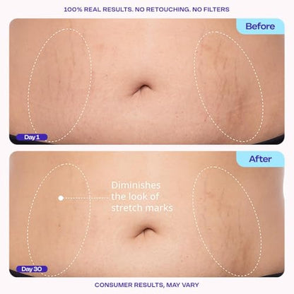Tighten & Smooth Belly Cream - Quick Absorbing for Smoother, Firmer-Looking Skin