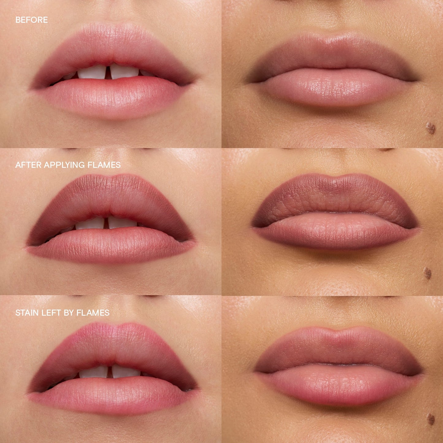 Flames|||LIP-LIN-FLA