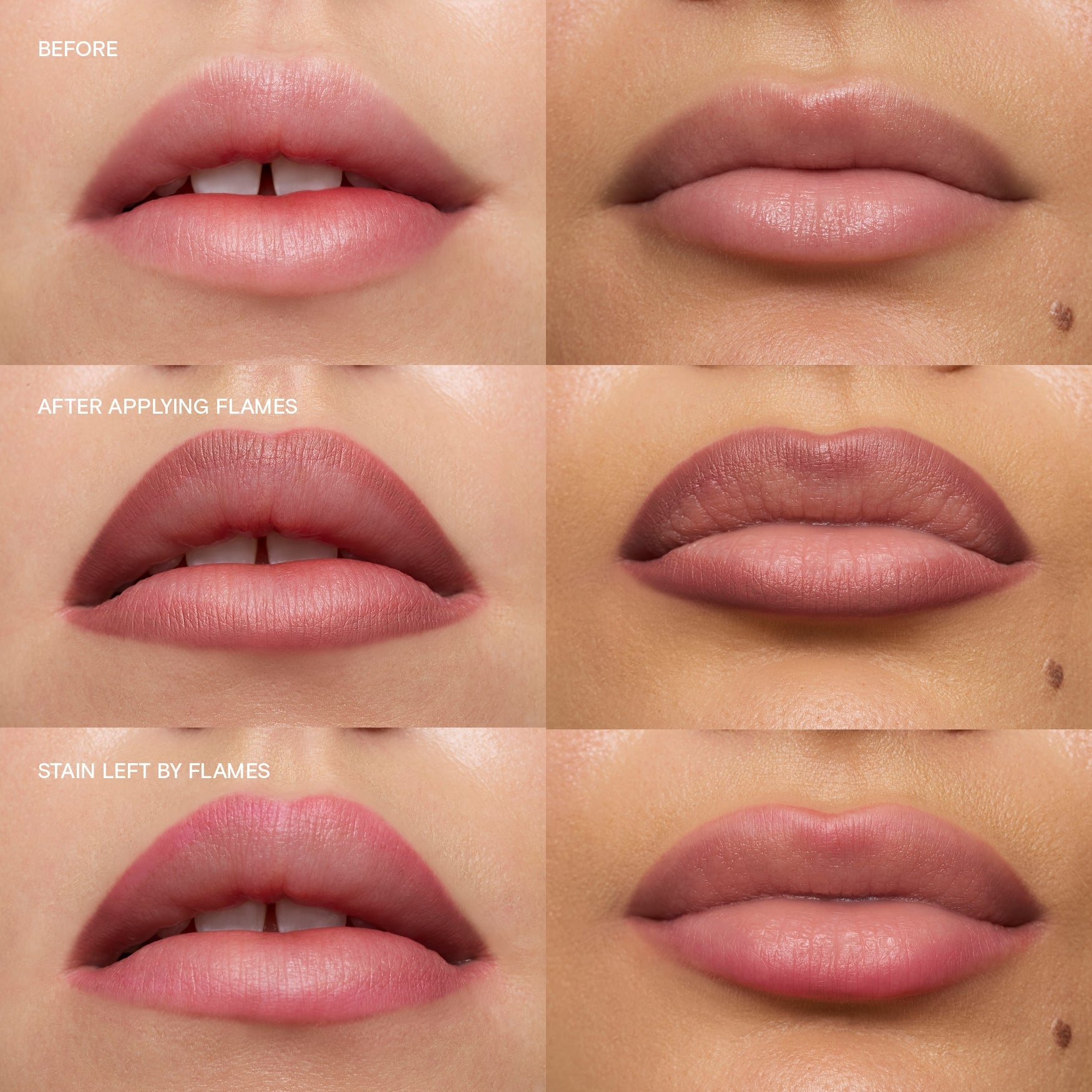 Flames|||LIP-LIN-FLA