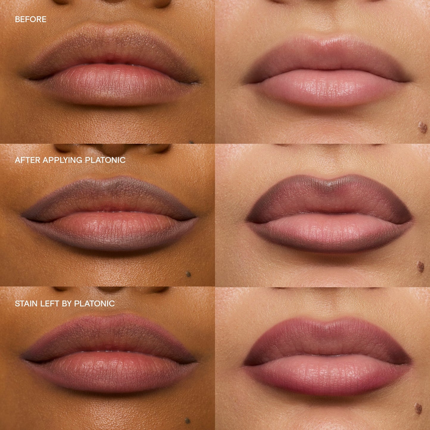 Platonic|||LIP-LIN-PLTC