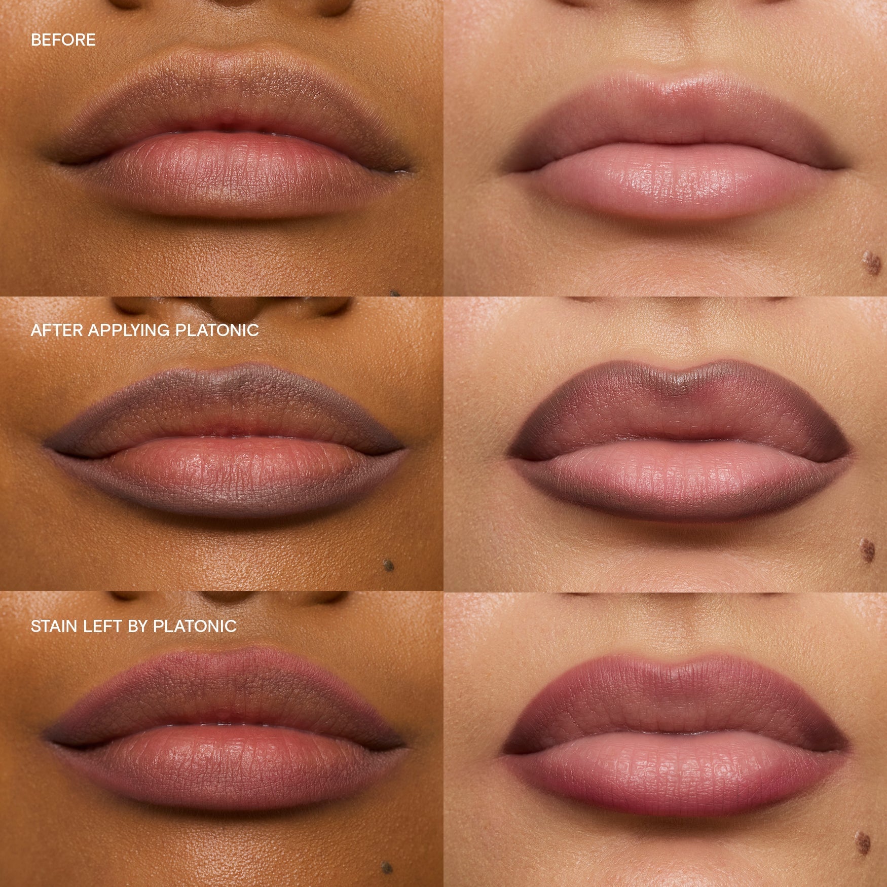 Platonic|||LIP-LIN-PLTC